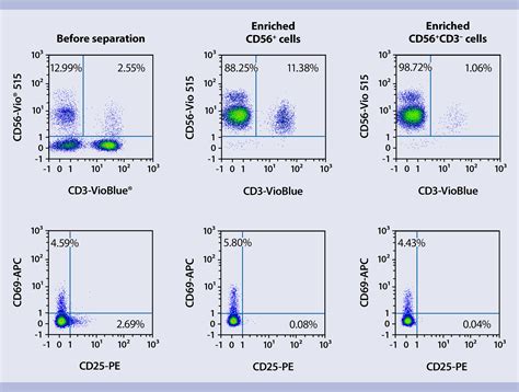 JCI Insight NK Cell Defects In X-linked Pigmentary, 60% OFF