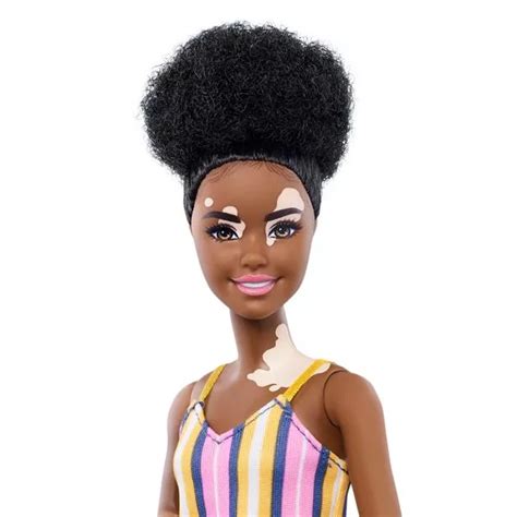 Barbie unveils new range of inclusive dolls, including one with a skin ...