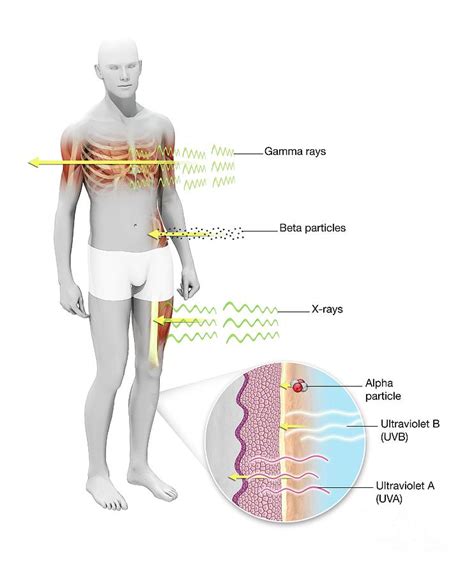 Radiation Effects On Humans Photograph by Mikkel Juul Jensen/science ...