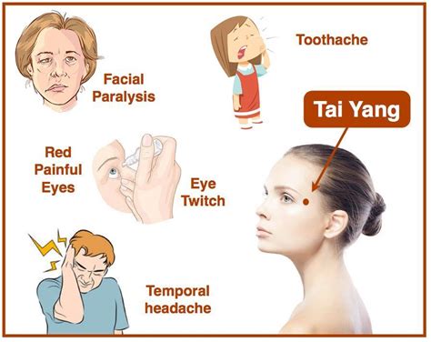 Extra Acupuncture Point Tai Yang is great for temporal headaches ...