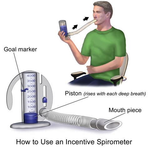 11.2 Basic Concepts of Oxygenation – Nursing Skills – 2e