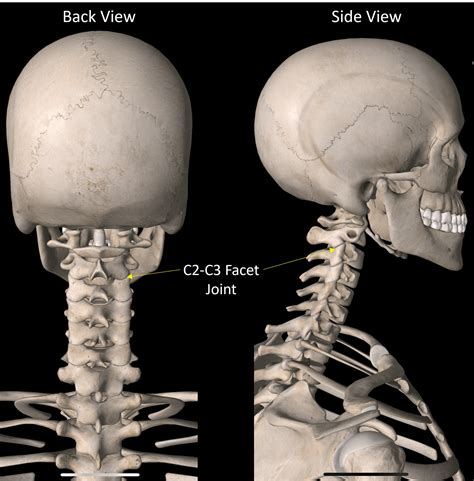 What's the Purpose of a Neck Facet Injection? - Regenexx