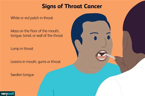 Throat Cancer Pictures: What Does It Look Like?