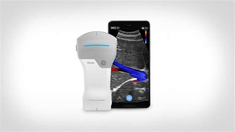 GE Healthcare Unveils Vscan Air - ICE