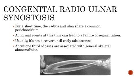 Radioulnar synostosis