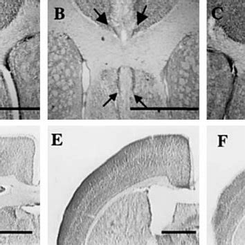 Nissl-stained coronal sections showing the presence of indusium griseum ...