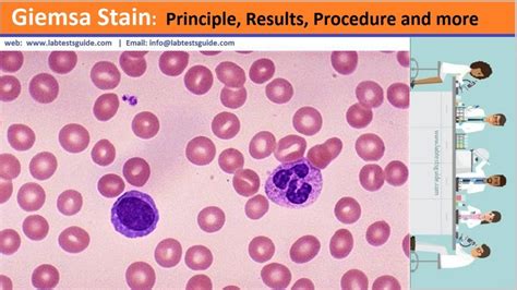 Giemsa Stain | Lab Tests Guide