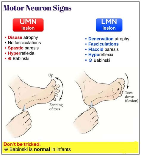 Nichtigkeit Aktivität spontan upper motor neurone signs Sonnenuntergang ...