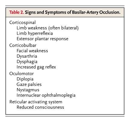 Vertebral Artery Stroke Symptoms