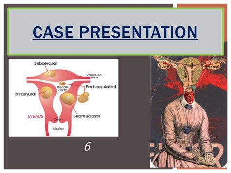 Myoma uteri presentation