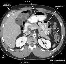 Cancer Tests - Abdominal CT Scan Services Service Provider from Kolhapur