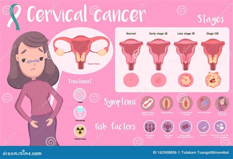 Cancer De Cervix