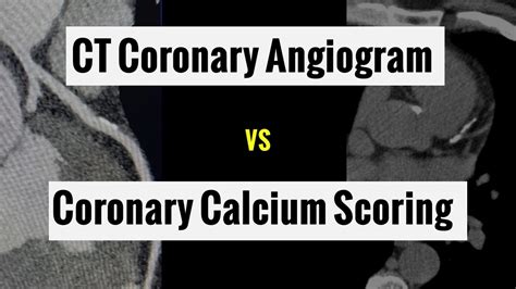 What is the difference between Coronary Calcium Scoring and CT Coronary Angiogram (2023) - YouTube