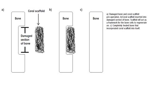 Osteoporosis or Osteo-porites: Can corals cure bone disease? | Coral ...