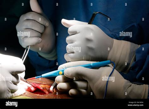 HEART SURGERY Stock Photo - Alamy