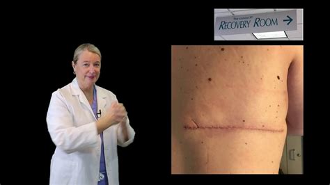 We're Talking Scar Tissue! - YouTube