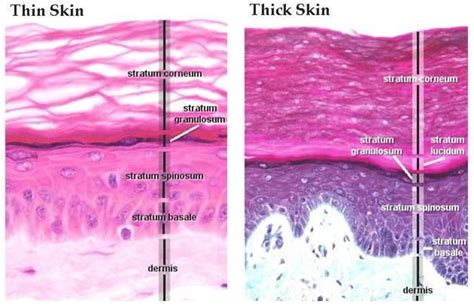 The stratum granulosum (or granular layer) is a thin layer of cells in the epidermis ...