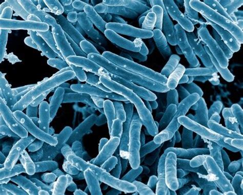 Inhibitors of Nontuberculous Mycobacteria Biofilms – CSU STRATA