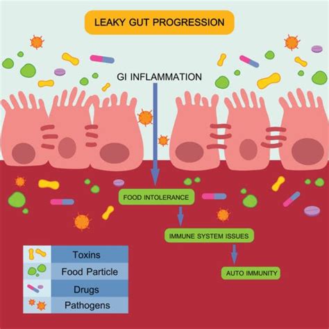 Leaky Gut- Leaky Gut Causes, What is Leaky Gut & Symptoms | PR