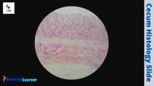 Cecum Histology Slide with Labeled Image and Diagram » AnatomyLearner ...