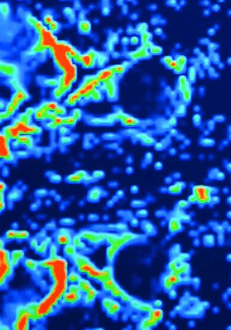 Magnetic Nanoparticles as MRI Contrast Agents | IntechOpen