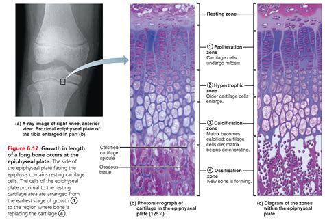 X-ray image of a right knee showing the epiphyseal plates of the articulating bones, and ...