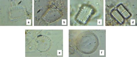 Images of Cyclotella sp. captured under 100x (oil immersion) objective.... | Download Scientific ...