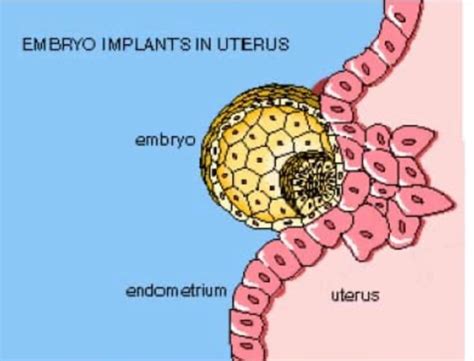 REPEATED IVF/ IMPLANTATION FAILURE (RIF) PART 2 | THISDAYLIVE