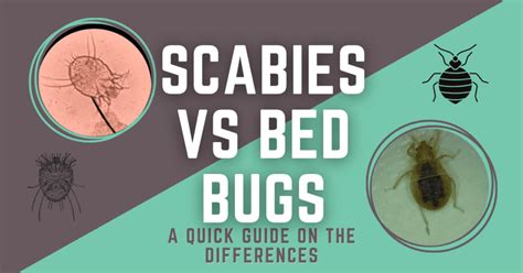 Scabies vs Bed Bugs: Quick Guide to Spot the Differences