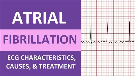 Atrial Fibrillation (A-Fib) ECG, Treatment, Causes, Nursing NCLEX Review ACLS - YouTube