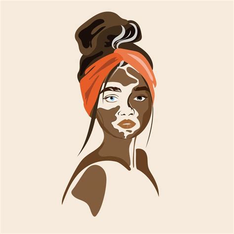 Stylish vitiligo woman portrait vector illustration in modern style.Beauty skin.World vitiligo ...