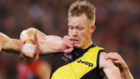 Flipboard: AFL 2019: Richmond’s Jack Riewoldt facing more time on sidelines with PCL knee injury