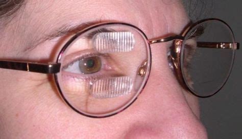 Prism Glasses Expand The View For Patients With Hemianopia | Glasses, Anti aging facial, Vision ...