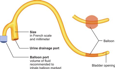 The parts of Foley catheter | Download Scientific Diagram