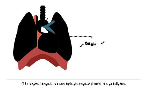 4 Stages of Mesothelioma | Symptoms & Treatment by Stage