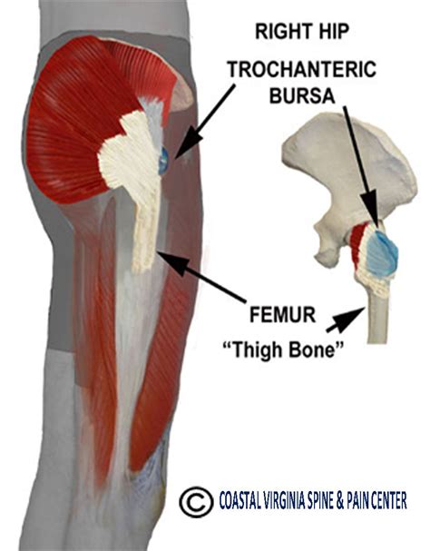 Trochanteric_bursa – Coastal Virginia Spine & Pain Center