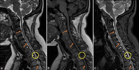 Surgical Neurology International