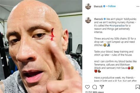 Dwayne Johnson suffers gym injury