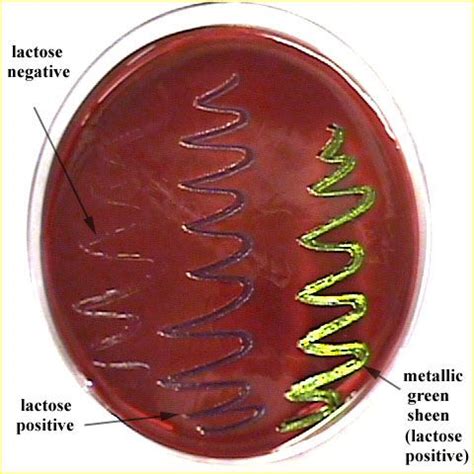 Eosin Methylene Blue Agar | Parasitologia, Microbiologia, Ciencias