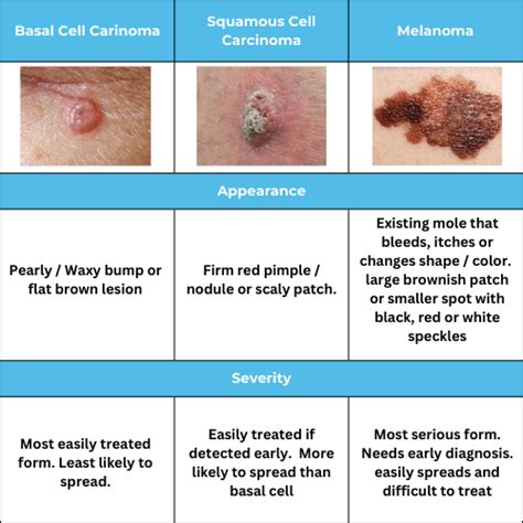 Self Screening Exams - Skin Cancer — Starlight Health