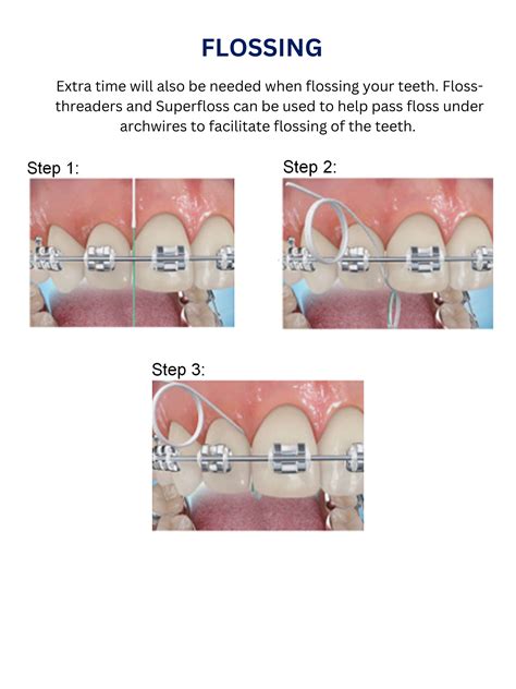 Flossing with Braces — Moore Orthodontics Affordable Orthodontist Lake Zurich