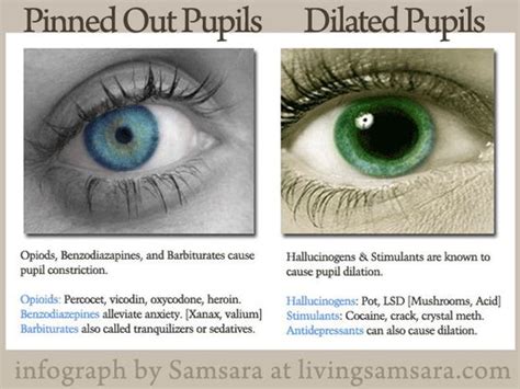 Pupil Dilation and Constriction via Drugs | health | Pinterest | Anonymous, Alcoholics anonymous ...