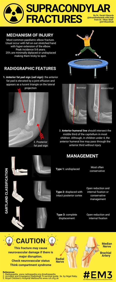 Supracondylar Fractures : r/emergencymedicine