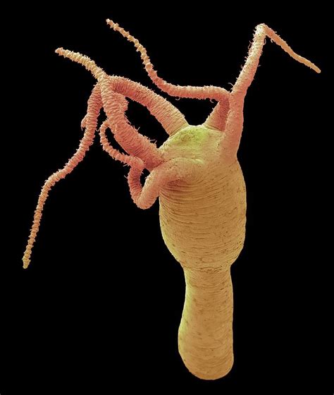 Hydra Photograph by Steve Gschmeissner/science Photo Library