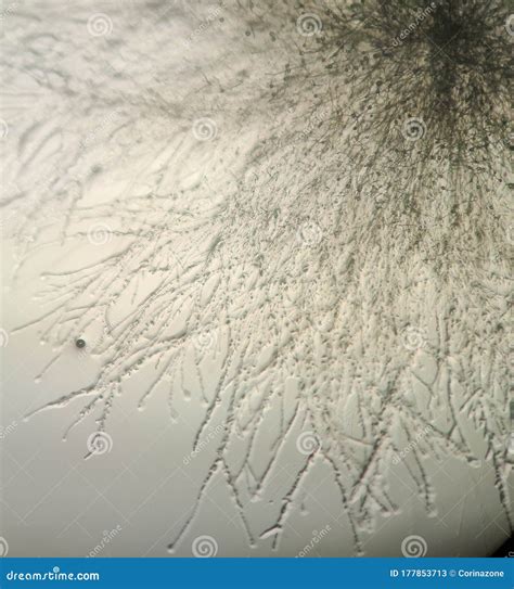 Fusarium Oxysporum Under the Microscope Stock Image - Image of biology ...