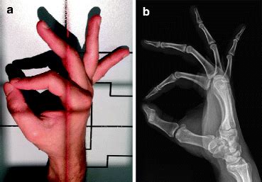 Radiological Investigations | Musculoskeletal Key