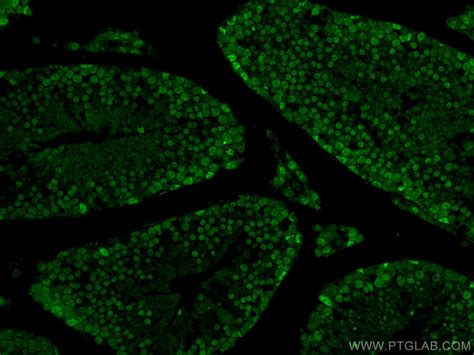 CREST antibody (12439-1-AP) | Proteintech