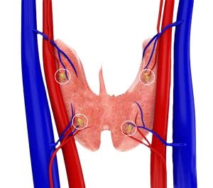 Parathyroid Surgery The Woodlands | Parathyroidectomy The Woodlands