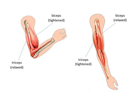 Spasticity and spasms | MS Trust