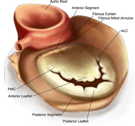 Figure 2 from Mitral annulus: an intraoperative echocardiographic perspective. | Semantic Scholar